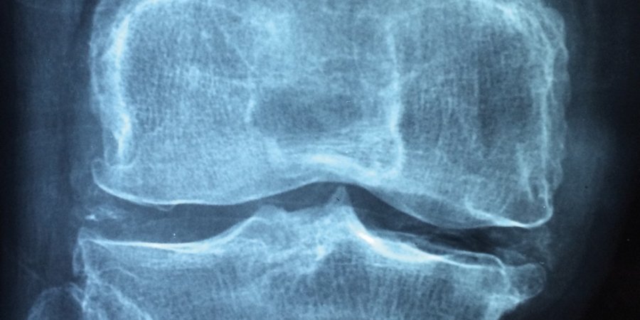 Von der Therapie zum Training: Die Diagnose