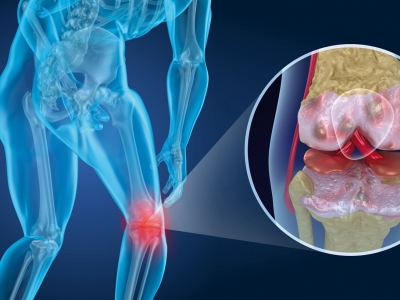 Die aktive Strategie ist die beste Wahl