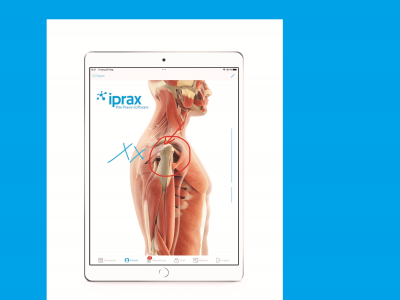 Präsentation des 3D-Buddy®