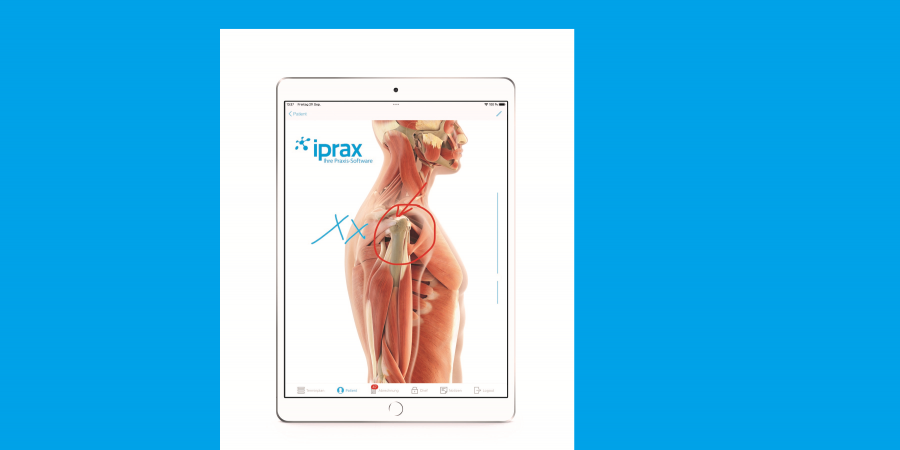 Präsentation des 3D-Buddy®